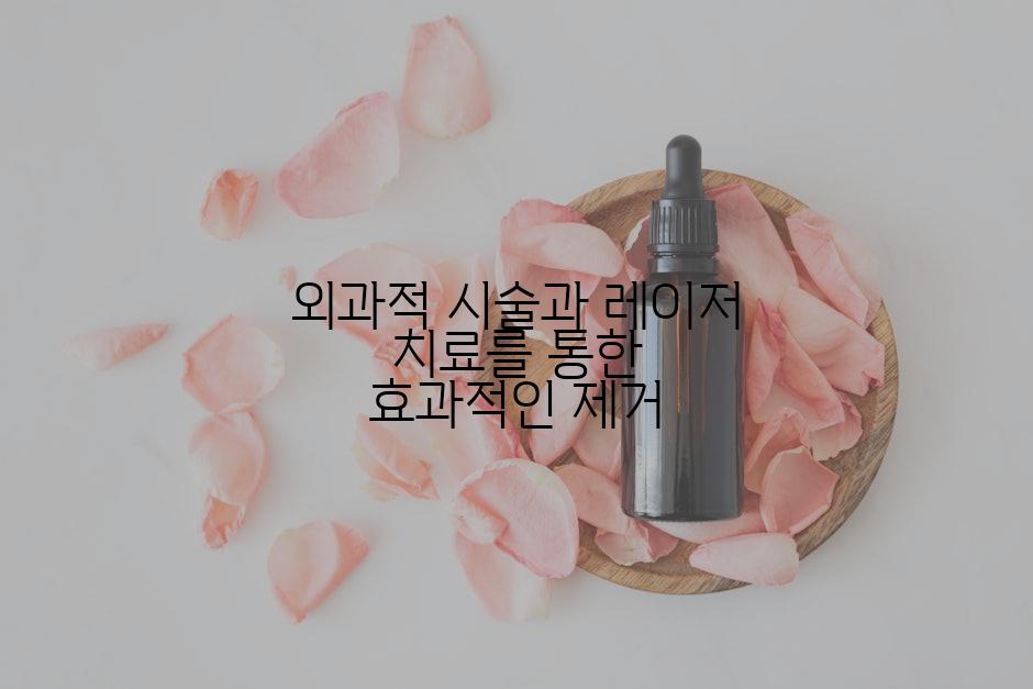 외과적 시술과 레이저 치료를 통한 효과적인 제거