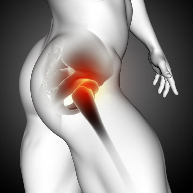 엉덩이 통증 저림 증상 원인