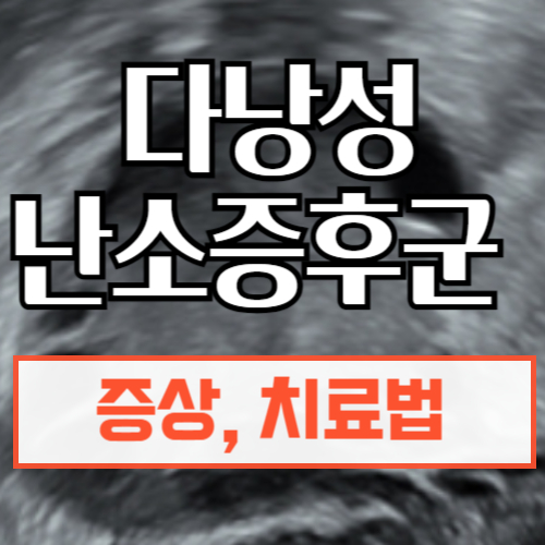 다낭성 난소 증후군 증상과 치료