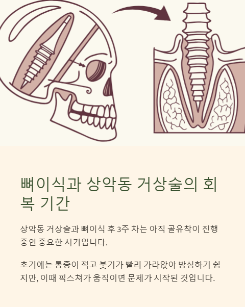 뼈이식과 상악동 거상술의 회복 기간