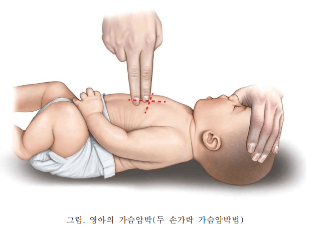 영아(1세 미만) 아기 심폐소생술 위치 그림