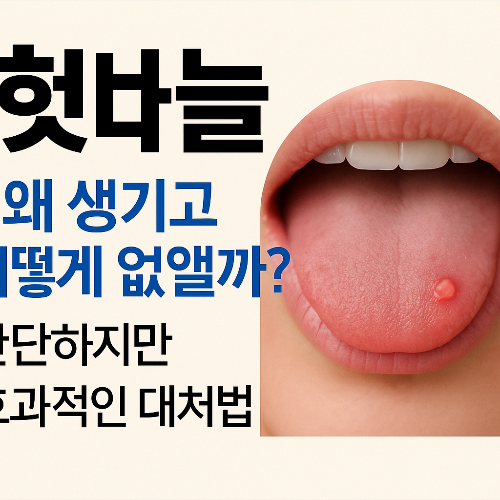혓바늘
