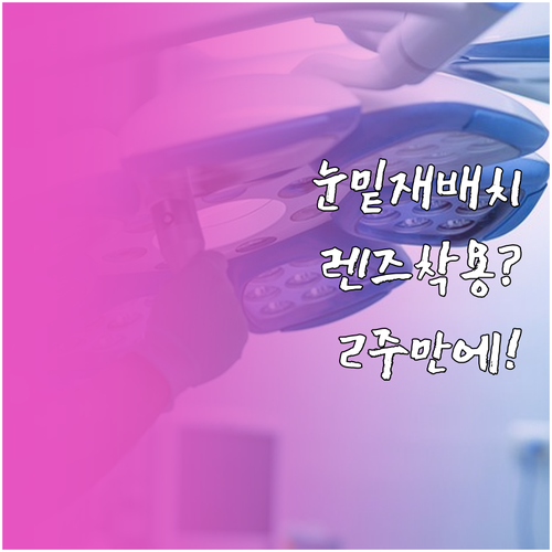 눈밑지방 재배치 수술 후 렌즈 착용,..