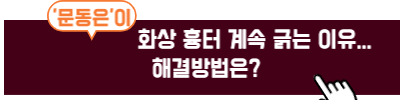 화상흉터