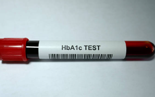 당화혈색소 검사