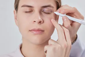 쌍꺼풀-수술-회복기간