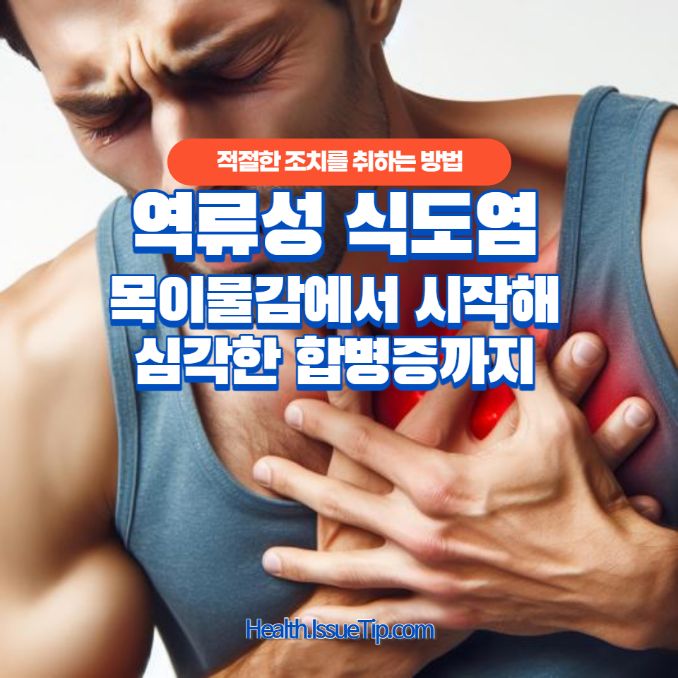 역류성 식도염 주요 증상