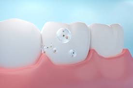 잇몸이 붓고 아플 때