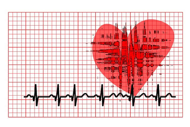 심전도(ECG) 분석 데이터