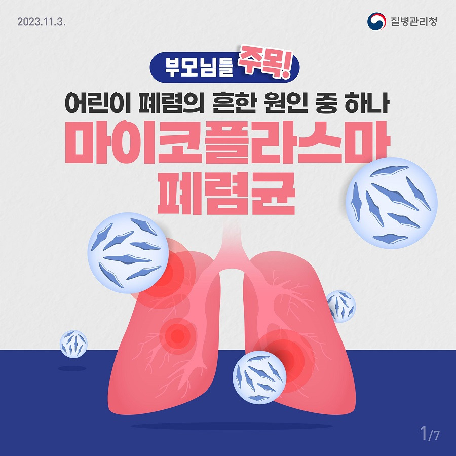 마이코플라즈마 폐렴
