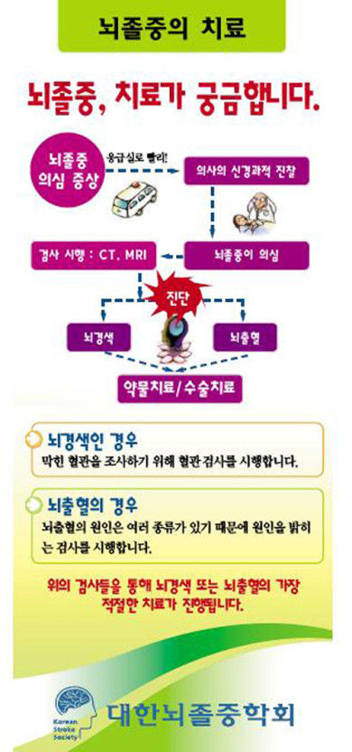 뇌졸중
