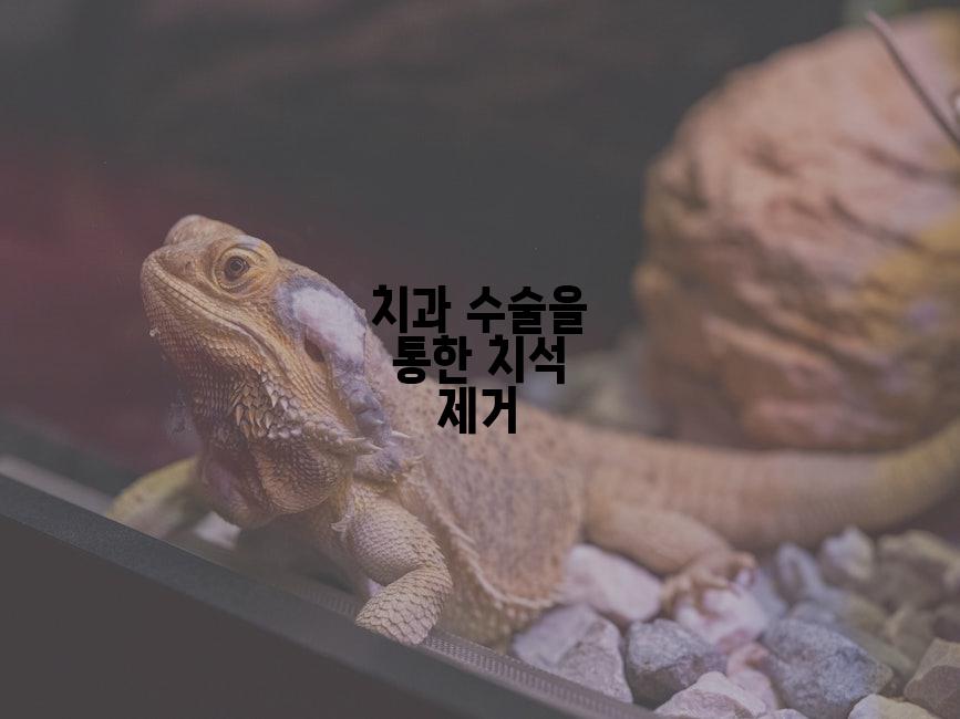 치과 수술을 통한 치석 제거