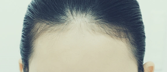 헤어라인 문신 전