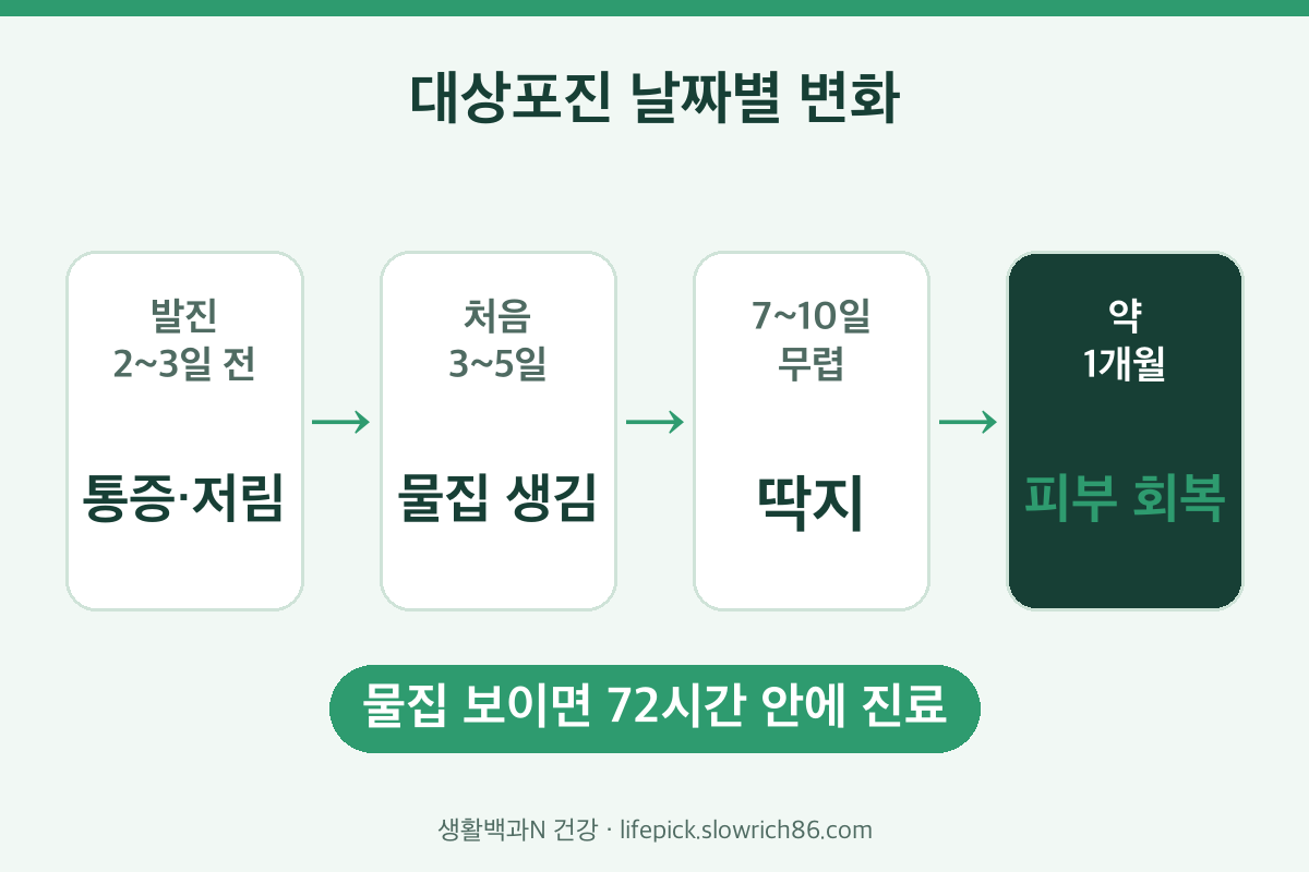 대상포진 초기증상부터 딱지까지 날짜별 변화 순서