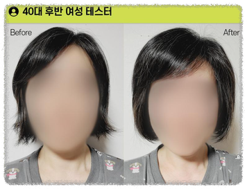 탈모샴푸 판매 1위 그래비티 여성 사용가능 안내