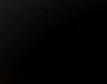 키 크는 영양제