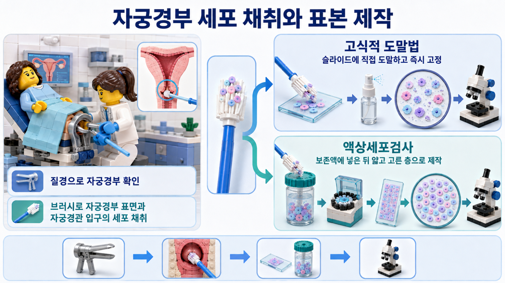 질경과 브러시를 이용한 자궁경부 세포 채취부터 고식적 도말법과 액상세포검사 표본 제작까지 비교한 이미지