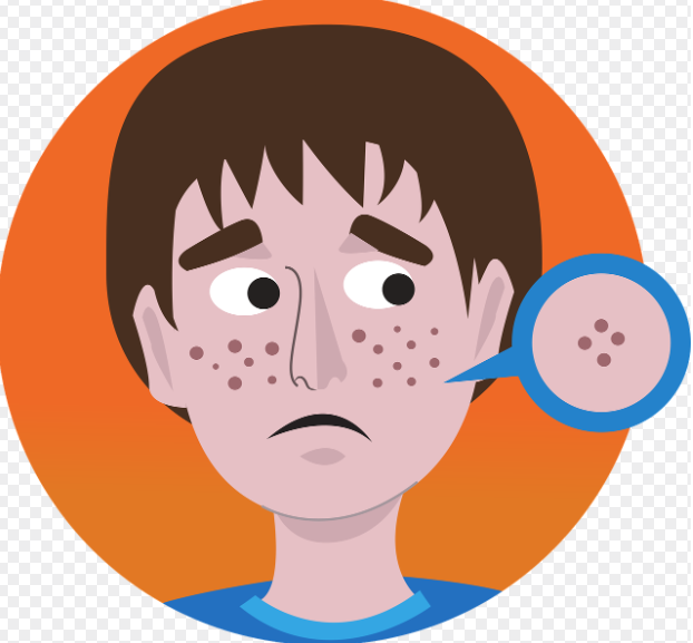 좁쌀여드름 발생 원인 관련 사진