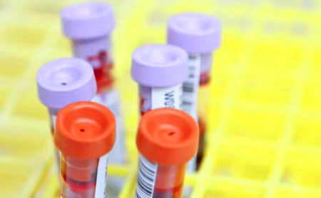 동맥경화증 초기증상