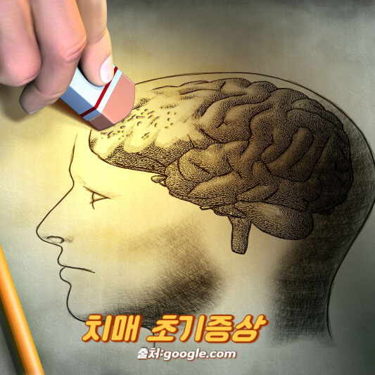 치매 초기증상 8가지