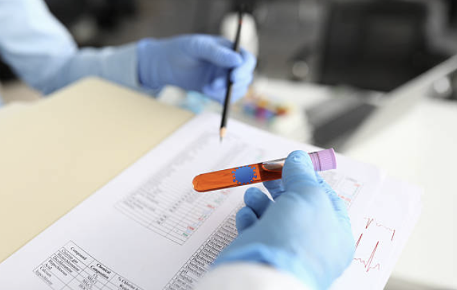 신약개발 초기 단계에서 Bioanalysis 팀이 가장 많이 겪는 10가지 리스크
