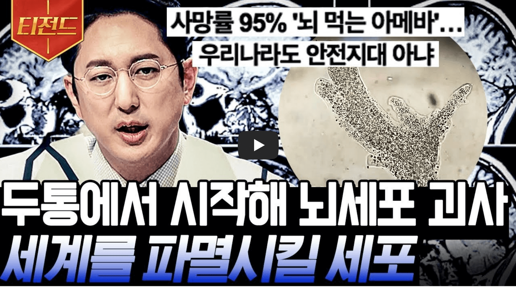 미국 뇌먹는 아메바 한국인 감염 사례