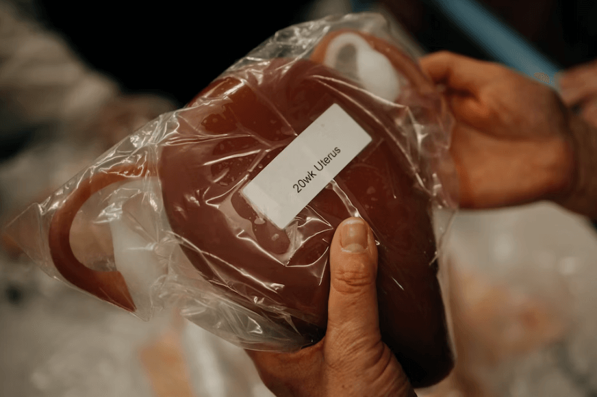 자궁경부암의-원인과-관리법