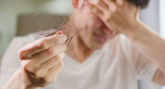 탈모