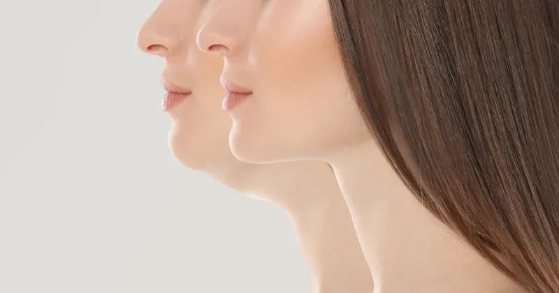 윤곽 주사 효과