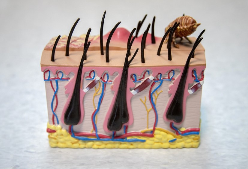 인천한방 탈모치료병원