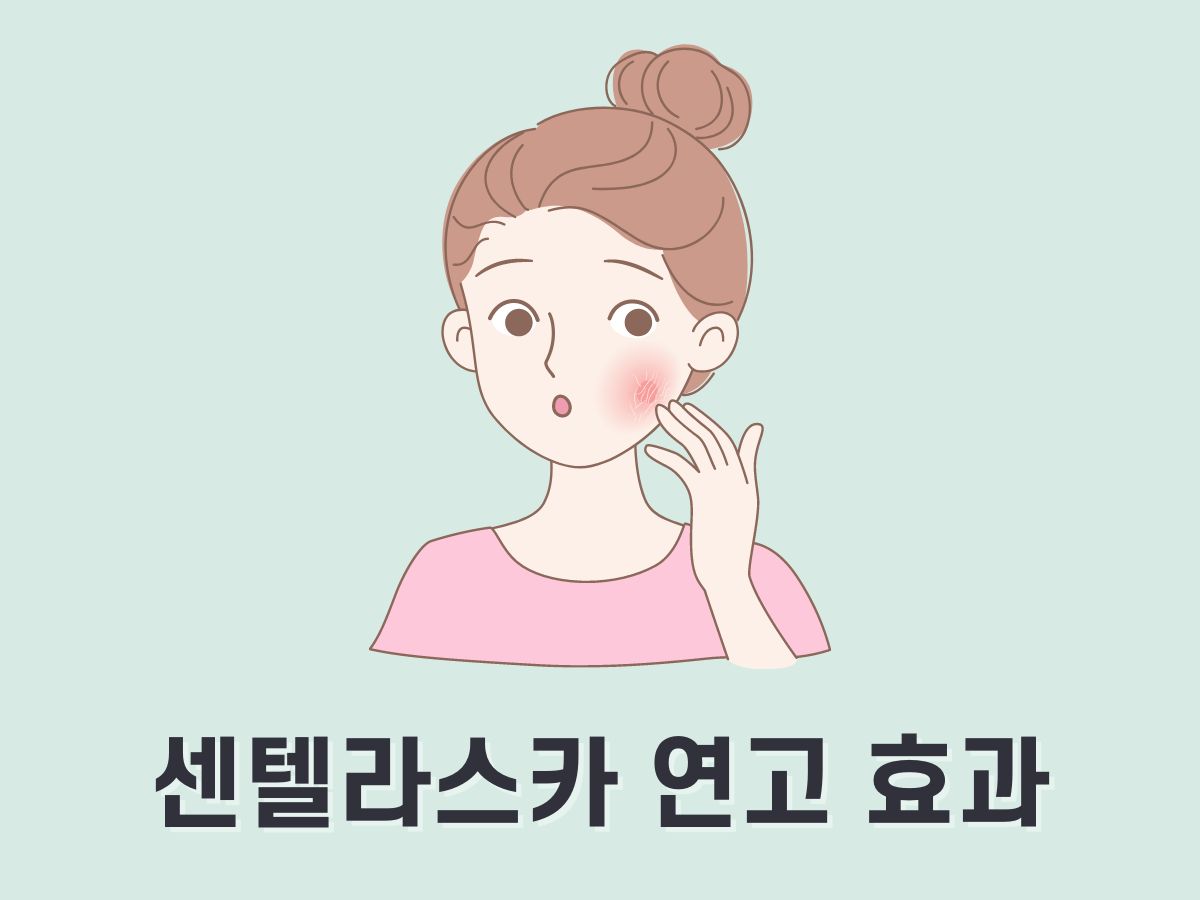 센텔라스카 연고 효과