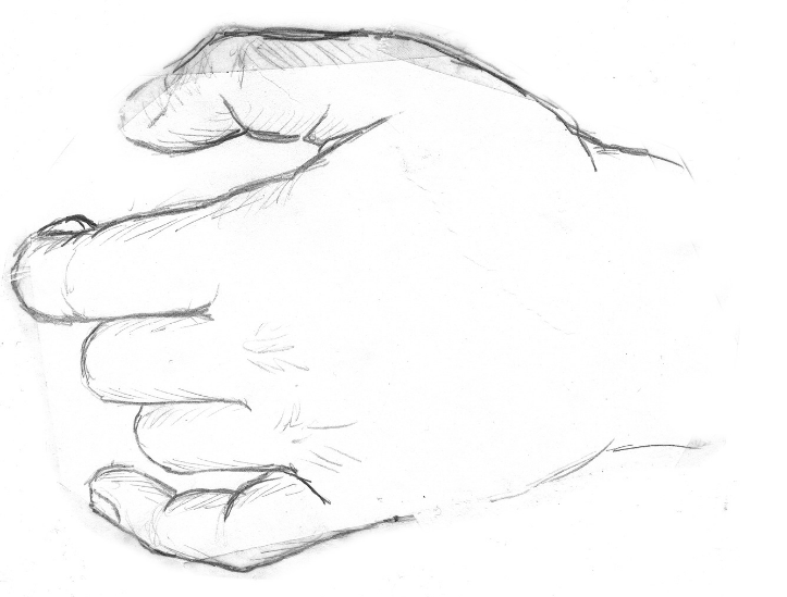 이상감각은 뇌졸중 후유증의 일환으로 나타날 수 있는 다양한 감각 이상을 포함한다