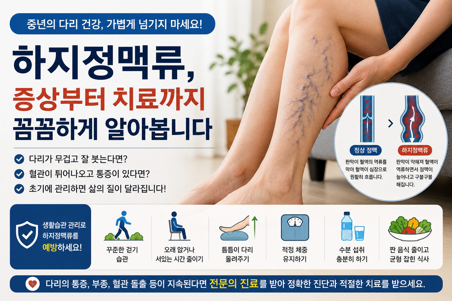 하지정맥류 증상과 치료
