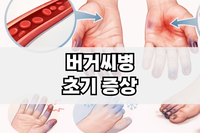 버거씨병 증상