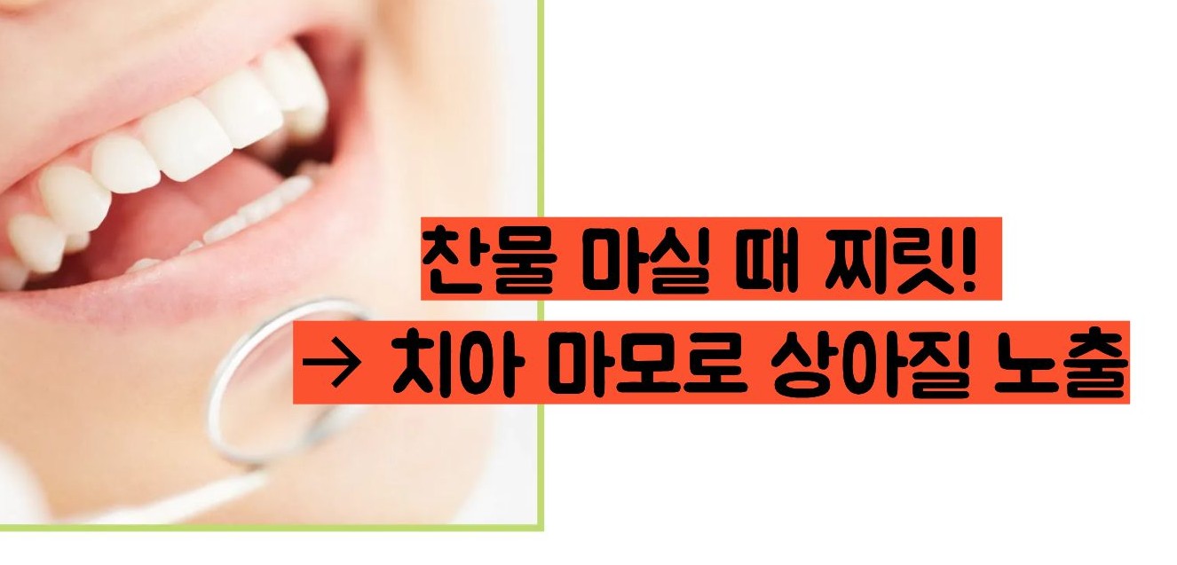 이빨이 시린 이유