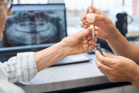 임플란트 뼈이식