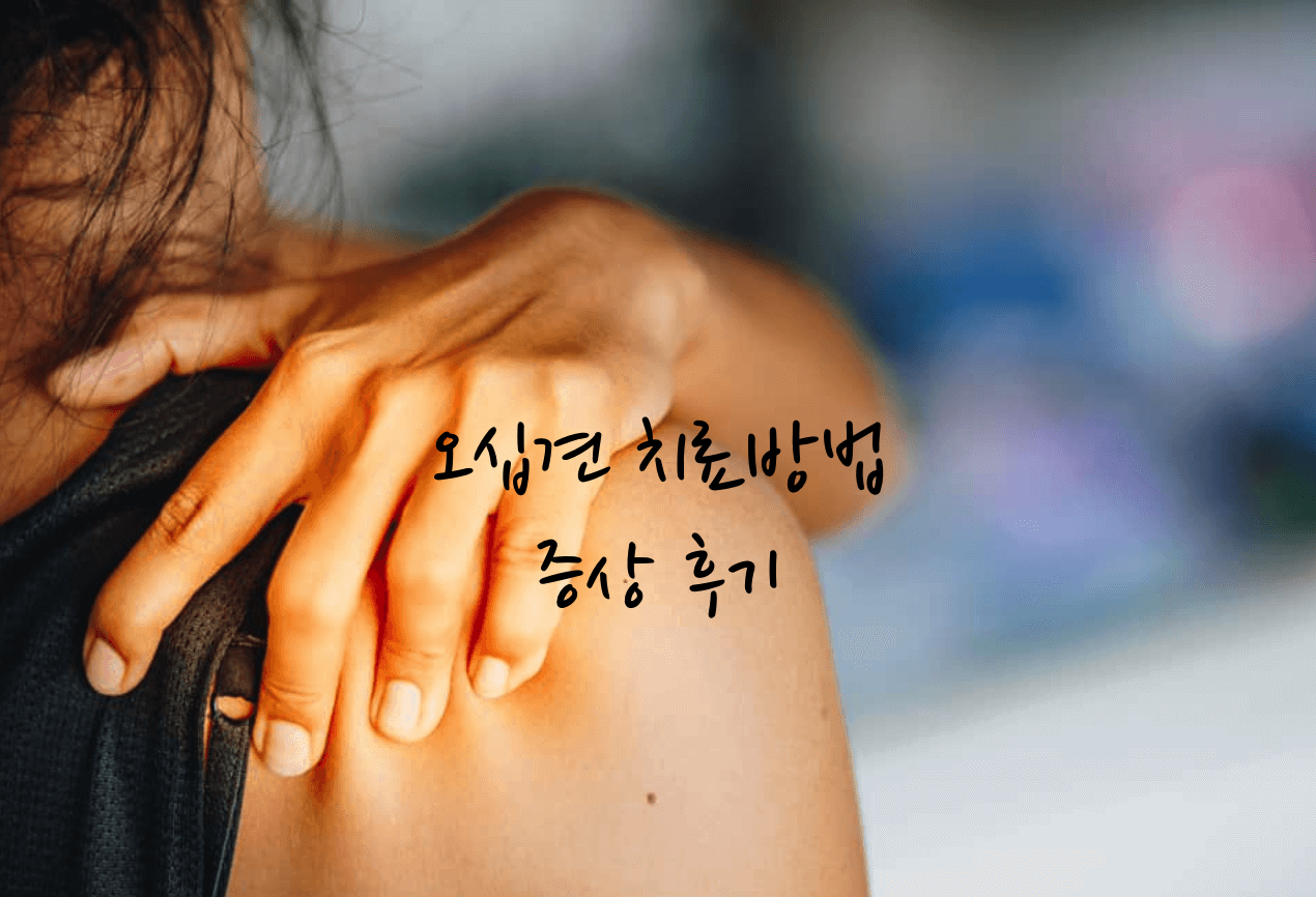 오십견