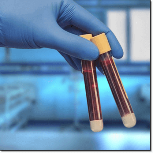 알부민 정상수치, 알부민 검사