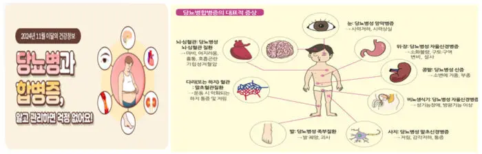 당뇨 전단계 관리방법