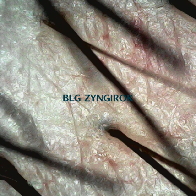 피나모아 29주차 - 뒷머리 두피모습이다.