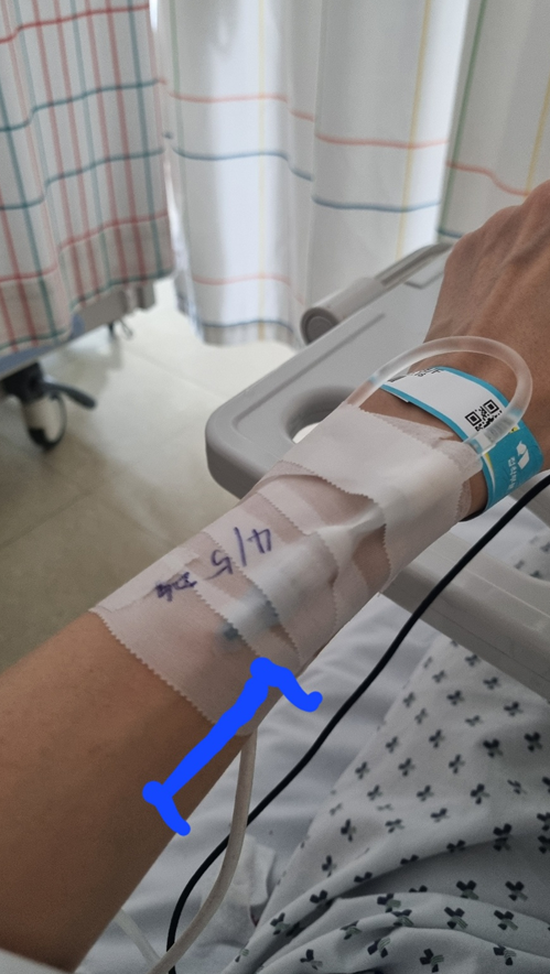 스테로이드펄스치료