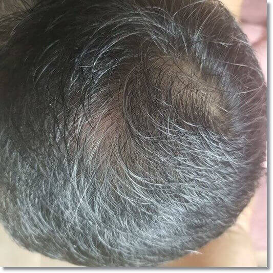 모발 변색이 심한 남성