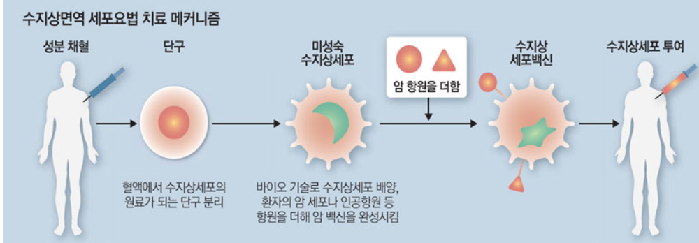 수지상면역 세포요법 치료 메커니즘