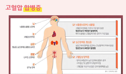 고혈압과 심장 건강 관련 이미지
