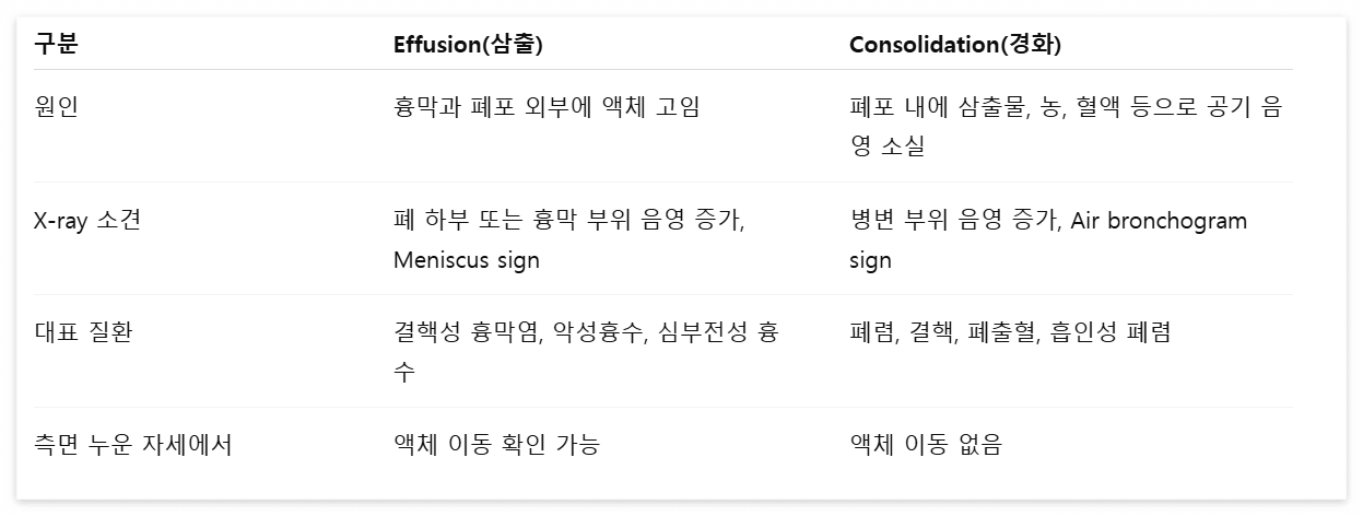 삼출과-경화-감별-포인트