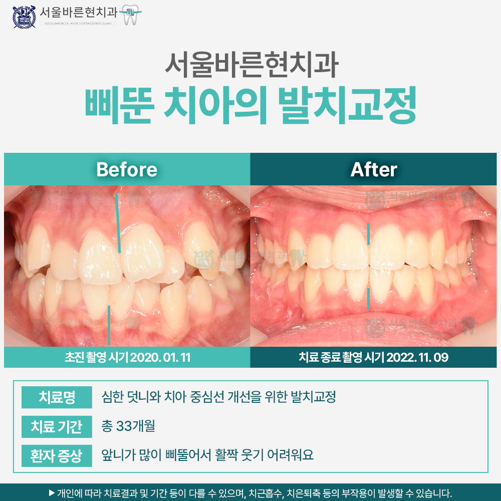 부산교정치과