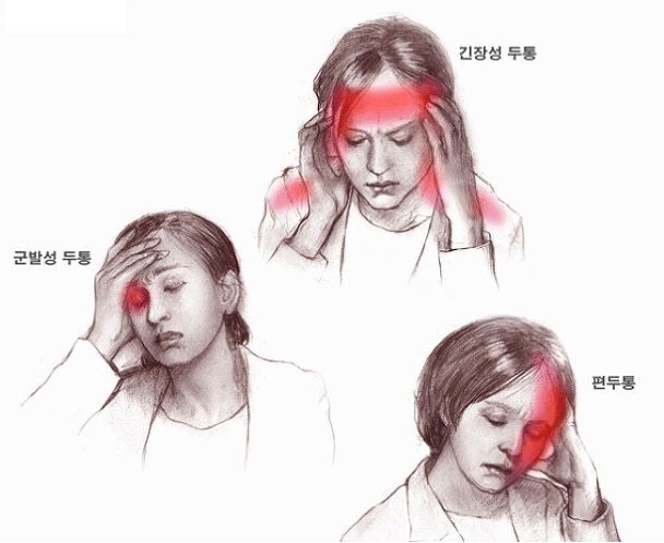 두통 종류