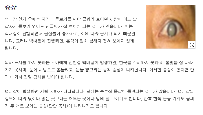 백내장의 증상 (Daum 질병백과)