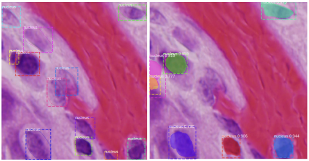 CH 03-0. Deep Learning for Biomedical Image - Convoluntional neural network(CNN) - Object Detection - Mask RCNN CH 03-0. Deep Learning for Biomedical Image - Convoluntional neural network(CNN) - Object Detection - Mask RCNN