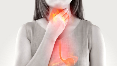 역류성 식도염 증상